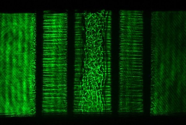 Plazmaoszlopok lézerfelvételen